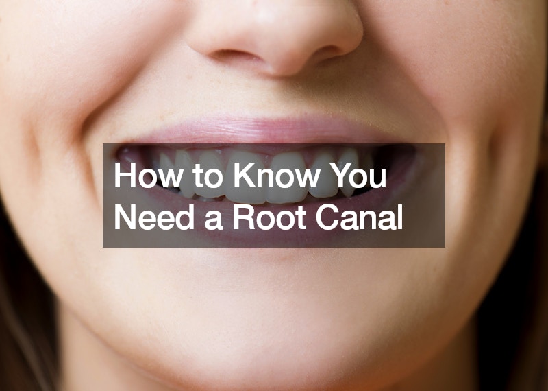 How to Know You Need a Root Canal