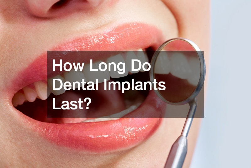 How Long Do Dental Implants Last?