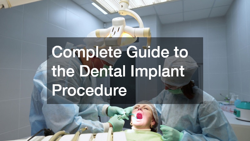 Complete Guide to the Dental Implant Procedure